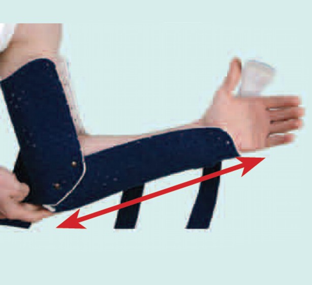 Kenőcs térdízületi sérülések esetén. Belső meniscus sérülés