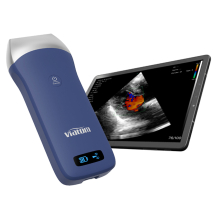 VIATOM lineáris vezeték nélküli orvosi ultrahang 7.5-10 MHz