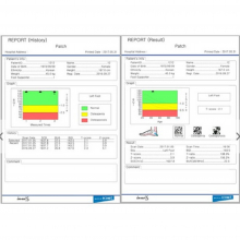 INUS S ultrahangos csontsűrűség mérő