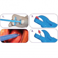 Méhnyak - cervix biopsziás fogó 21,5cm - steril 25db/doboz