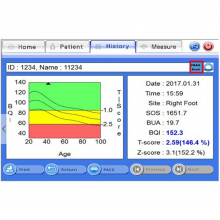 INUS S ultrahangos csontsűrűség mérő