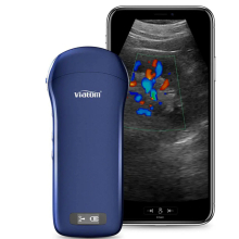 VIATOM lineáris/convex/cardialis vezeték nélküli orvosi ultrahang 7.5-10 MHz / 3.5-5 MHz / 2.5-5 MHz
