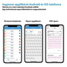 Viatom Pulsebit EX személyi EKG