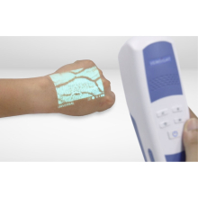 VEINSIGHT™ VS500 professzionális vénakaerső, vénascenner