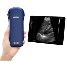 VIATOM lineáris/convex/cardialis vezeték nélküli orvosi ultrahang 7.5-10 MHz / 3.5-5 MHz / 2.5-5 MHz