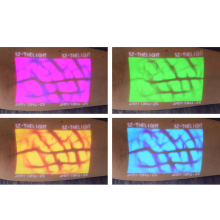 Enmind VV-100 professzionális vénakaerső, vénascenner