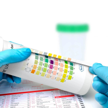 ROCHE COMBUR vizelet teszt 100 db/doboz