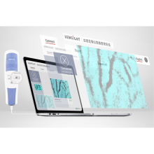 VEINSIGHT™ VS500 professzionális vénakaerső, vénascenner