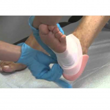 ALLEVYN HEEL hidrocelluláris habkötszer ragasztószegély nélkül 10,5 x 13,5 cm