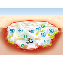 SUPRASORB A+Ag kálciumalginát ezüsttel kötszer 10 x 20 cm (5)