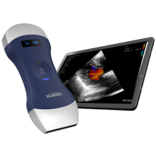 VIATOM lineáris/convex vezeték nélküli orvosi ultrahang 7.5-10 MHz / 3.5-5 MHz