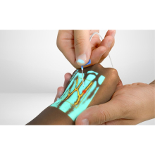 VEINSIGHT™ VS500 professzionális vénakaerső, vénascenner