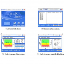 INUS S ultrahangos csontsűrűség mérő