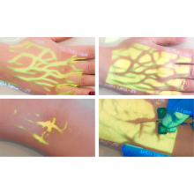 Enmind VV-100 professzionális vénakaerső, vénascenner