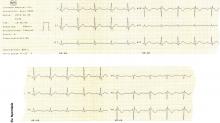 EKG készülék HeartScreen 80G-L1