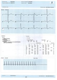 EKG szoftver InnoBase for Windows