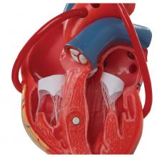 Klasszikus szív bypass-szal, 2 részes